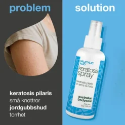 Australian Bodycare Salicylic Acid Keratosis Spray 100 ml