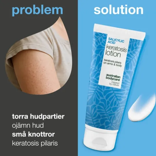 Australian Bodycare Salicylic Acid Keratosis Lotion 200 ml