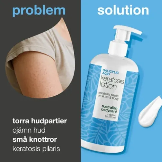Australian Bodycare Salicylic Acid Keratosis Lotion 500 ml