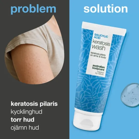 Australian Bodycare Salicylic Acid Keratosis Wash 200 ml