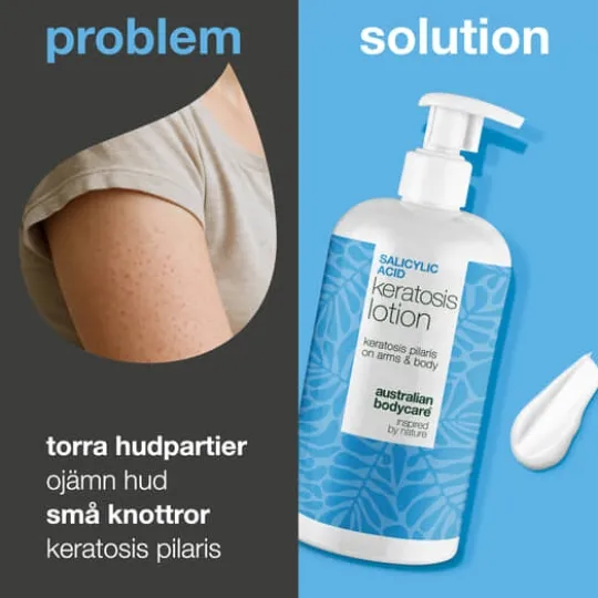 Australian Bodycare Salicylic Acid Keratosis Lotion 500 ml