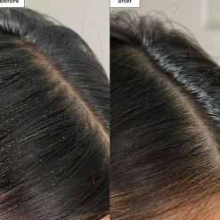 Briogeo Scalp Revival Charcoal + Tea Tree Buildup Detox Spray 120 ml
