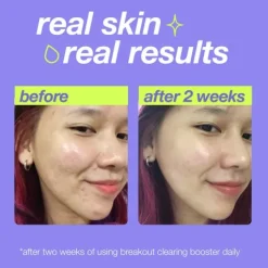 Dermalogica Breakout Clearing Booster 30 ml