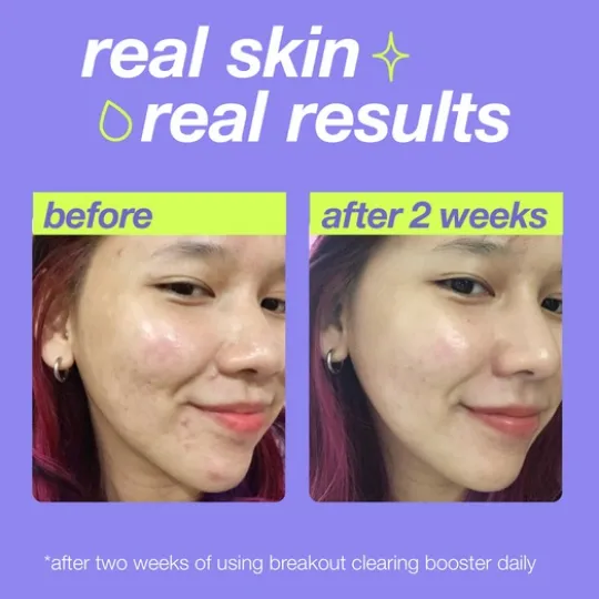 Dermalogica Breakout Clearing Booster 30 ml