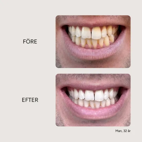 Etinour Essential Whitening & Remineralizing Kit