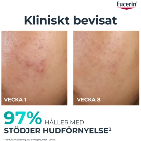 Eucerin DermoPure Peeling 10 40 ml