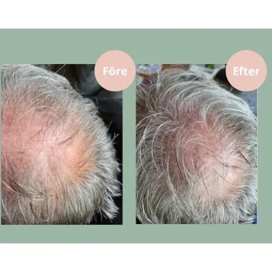 Hjärtligt Hair Growth Balsam 250 ml