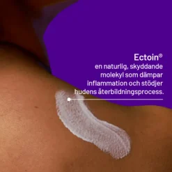 Locobase Psoriasis Cream 50 ml