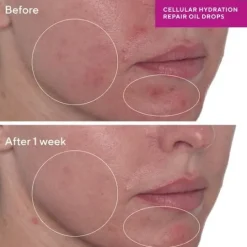 Murad Cellular Hydration Repair Oil Drops 30 ml