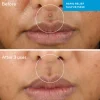 Murad Rapid Relief Sulfur Mask 75 ml