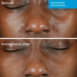 Murad Rapid Relief Sulfur Mask 75 ml
