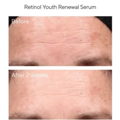 Murad Retinol Youth Renewal Serum 30 ml