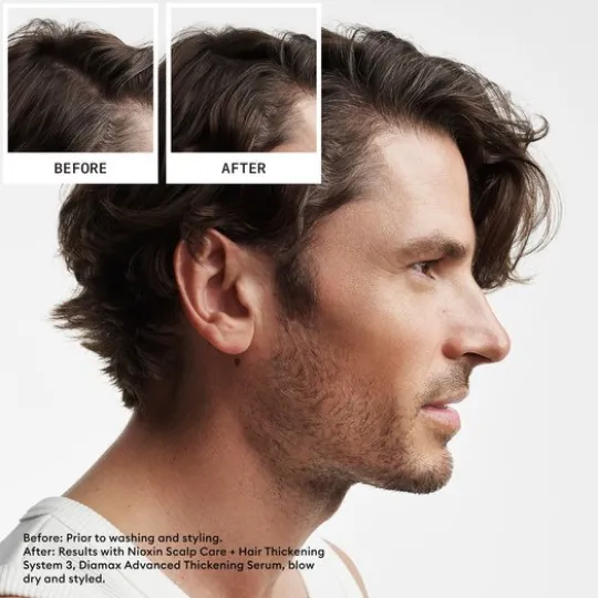 Nioxin System 2 Loyalty Kit