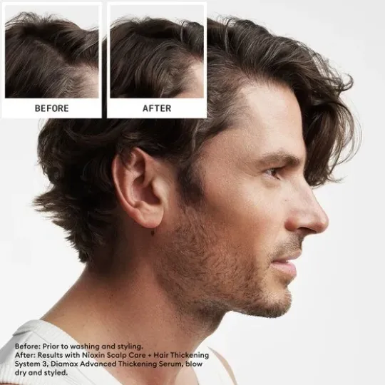 Nioxin System 2 Loyalty Kit