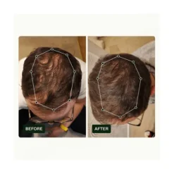 Scandinavian Biolabs Hair Routine Kit Men