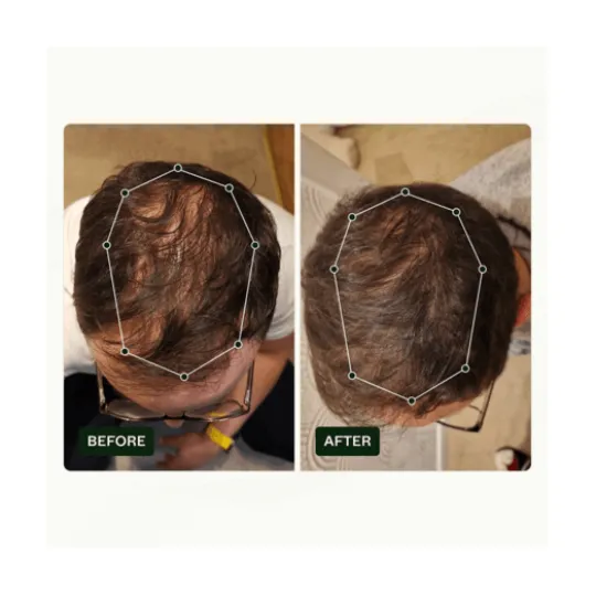 Scandinavian Biolabs Hair Routine Kit Men