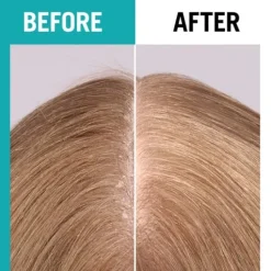 Schwarzkopf Gliss Scalp Balance Gentle Shampoo 200 ml
