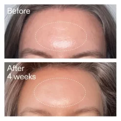 The INKEY List Advanced Retinal Serum 15 ml