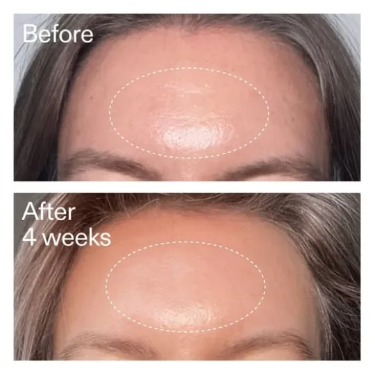 The INKEY List Advanced Retinal Serum 15 ml