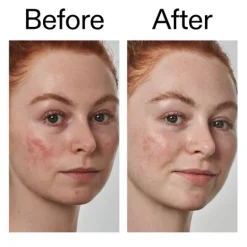 The INKEY List Azelaic Acid 10% Serum 30 ml