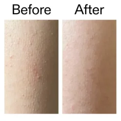 The INKEY List Glycolic Acid Exfoliating Body Stick 45 g