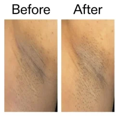 The INKEY List Glycolic Acid Exfoliating Body Stick 45 g