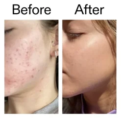 The INKEY List Niacinamide Serum 30 ml