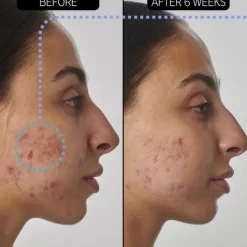 The INKEY List Retinol 1% Serum 30 ml