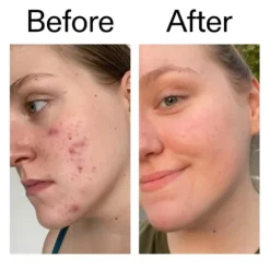 The INKEY List 15% Vitamin C and EGF Serum 30 ml