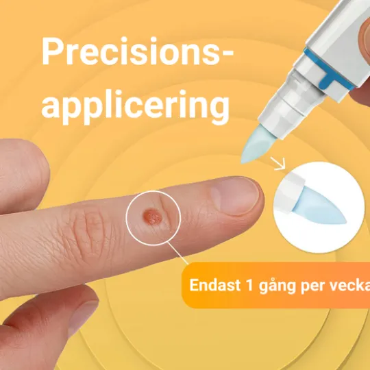 Vårtfri Pen 30 st